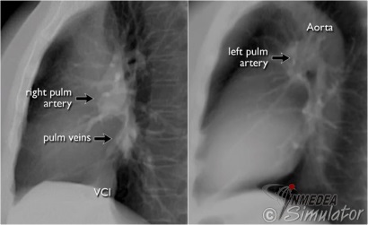 (Bildquelle: www.radiologyassisstant.nl)